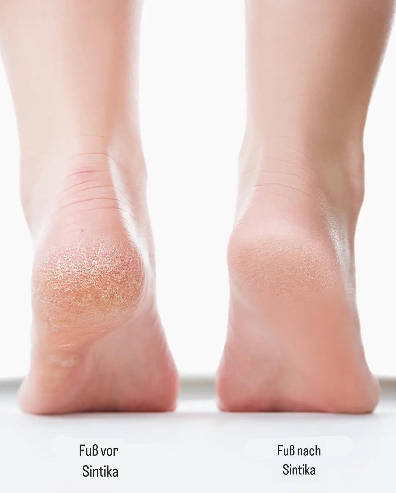 SmoothStep elektrisk fodfil | Ubesværet pleje for smukke fødder-zarada.dk