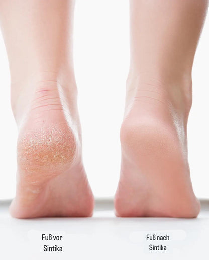 SmoothStep elektrisk fodfil | Ubesværet pleje for smukke fødder-zarada.dk